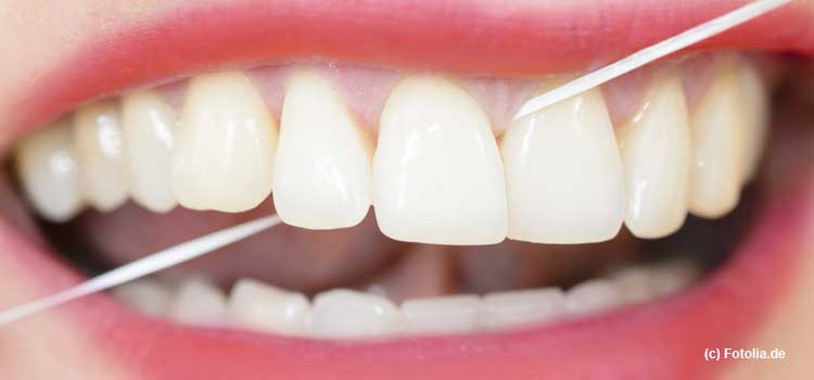 Trotz gestiegenem Gesundheitsbewußtsein kommt die Pflege der Zahnzwischenräume mit Zahnseide noch immer zu kurz, ist aber sehr wichtig.