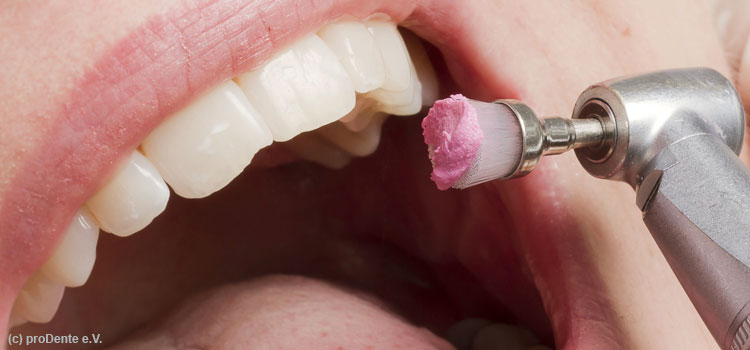 Professionelle Zahnpflege (PZR)