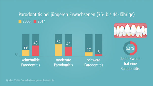 Parodontitis bei jüngeren Erwachsenen (35- bis 44-Jährige)