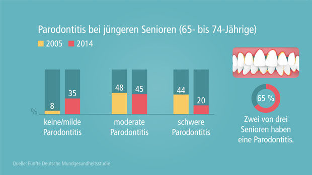 Parodontitis bei jüngeren Senioren (65- bis 74-Jährige)